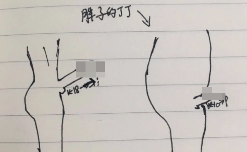 为什么肥胖男人的那玩意更短小呢