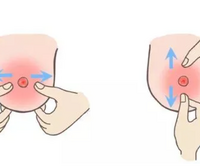 乳头不突出反而陷进去了是怎么回事