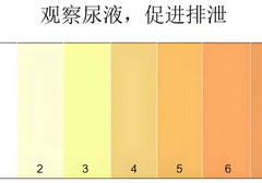 这种颜色的尿，是好尿
