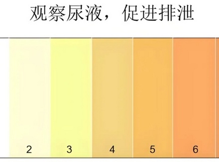 这种颜色的尿，是好尿