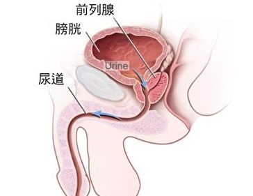 男生的前列腺真的有G点吗