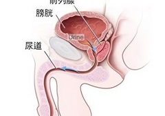 男生的前列腺真的有G点吗