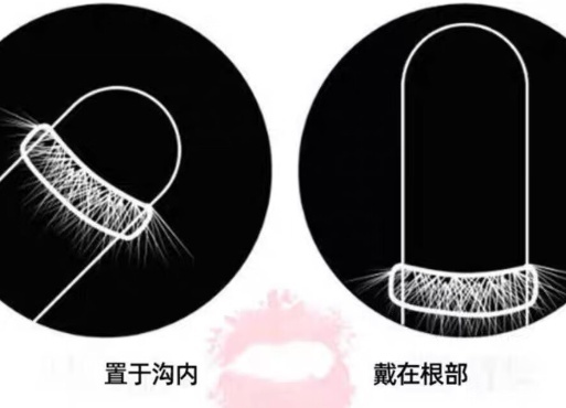 羊毛圈（羊眼圈）安全套的正确使用方法