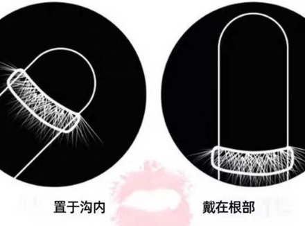 羊毛圈（羊眼圈）安全套的正确使用方法