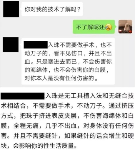 男的镶珠是怎么回事？真的会让女生更刺激？