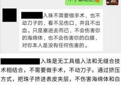 男的镶珠是怎么回事？真的会让女生更刺激？