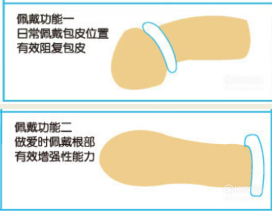 锁精环带在哪里,锁精环怎么戴