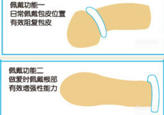 锁精环带在哪里，锁精环怎么戴