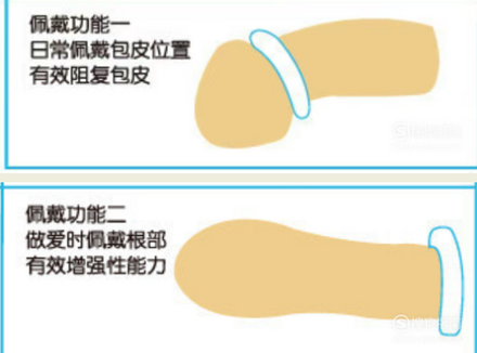 锁精环带在哪里，锁精环怎么戴