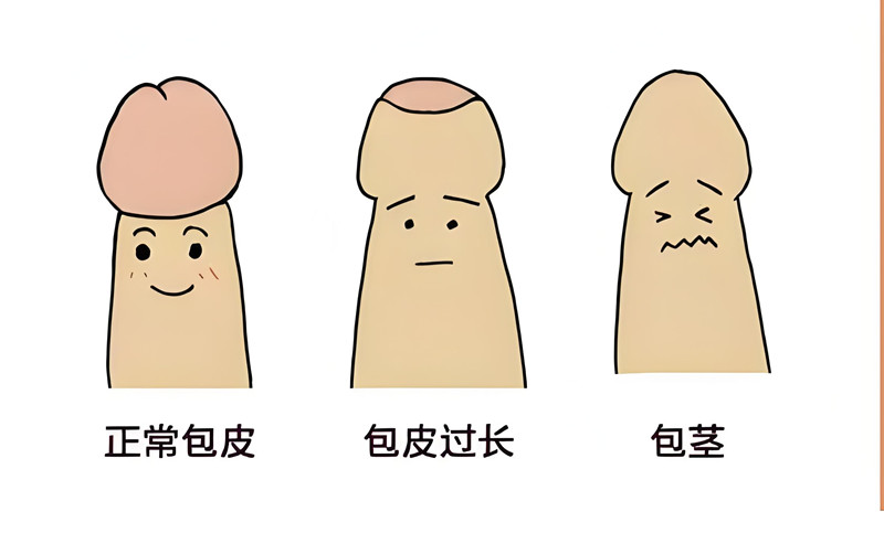 如何正确选购延时喷剂，关键问题全分析
