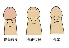 如何正确选购延时喷剂，关键问题全分析