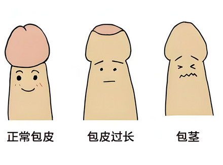 如何正确选购延时喷剂，关键问题全分析
