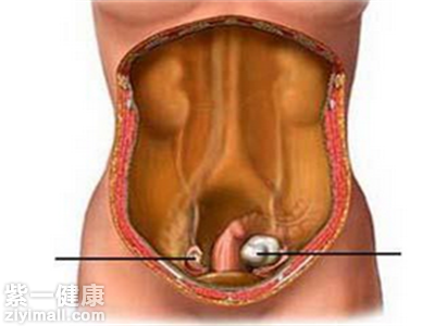 睾酮的生理作用有哪些 解析睾酮的五大生理作用