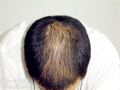 怎么看自己有没有肾虚 从8大症状来判断是否肾虚