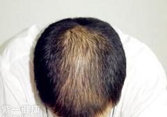 怎么看自己有没有肾虚 从8大症状来判断是否肾虚