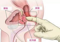 新手怎样才能快速触发前高的快乐感