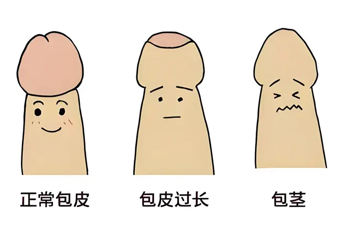 如何正确选购延时喷剂，关键问题全分析