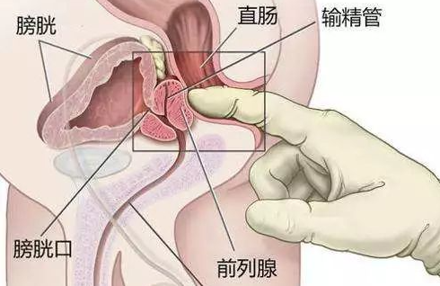 前列腺Gāo巢的感觉，就像飞上了天堂！