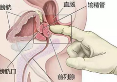前列腺Gāo巢的感觉，就像飞上了天堂！