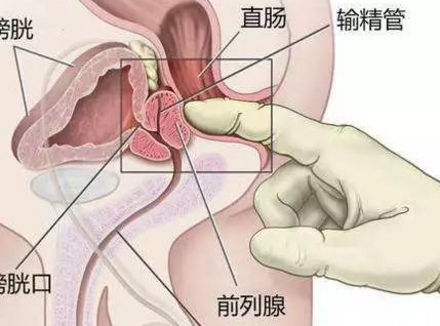 前列腺Gāo巢的感觉，就像飞上了天堂！