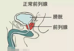前列腺的准确位置，附部位图！