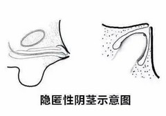 科普:肥胖的男人，“丁丁”为什么会缩小 ?