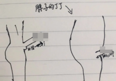 为什么肥胖男人的那玩意更短小呢