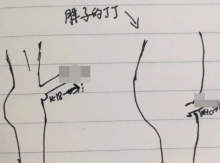 为什么肥胖男人的那玩意更短小呢