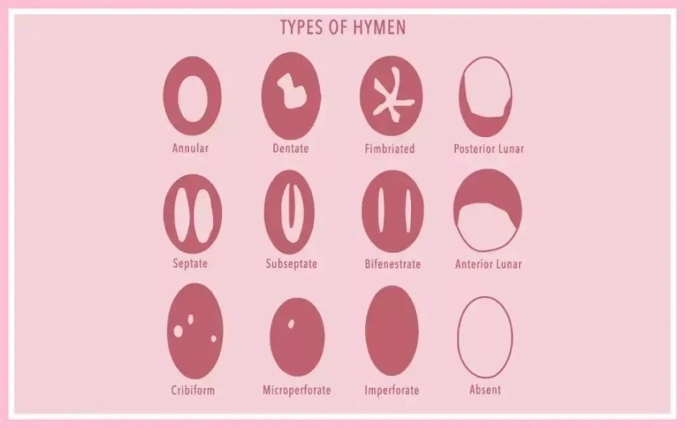 女生第一次一定会流血吗