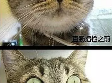 听说前列腺按摩很爽，是真的吗?