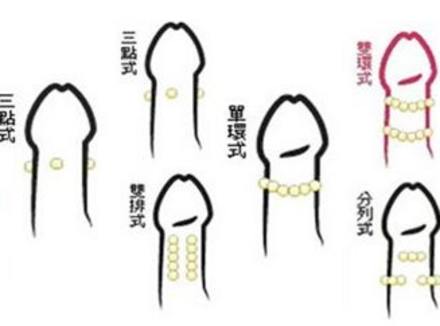 丁丁埋珠子的主要原因