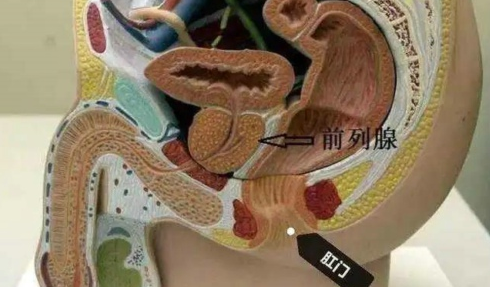 什么是前列腺炎?为什么会得前列腺炎？