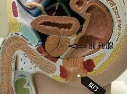 什么是前列腺炎?为什么会得前列腺炎？