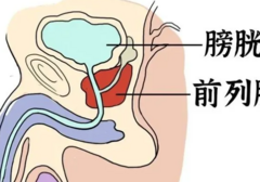 前列腺，男人的“生命线”！