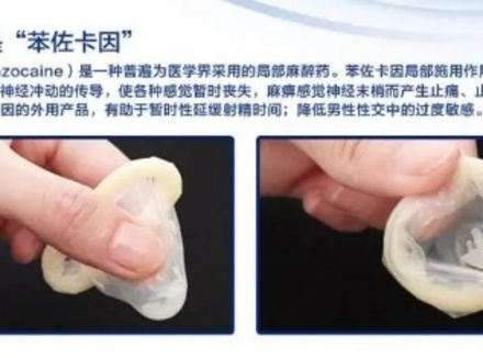 避孕套里面的苯佐卡因是什么