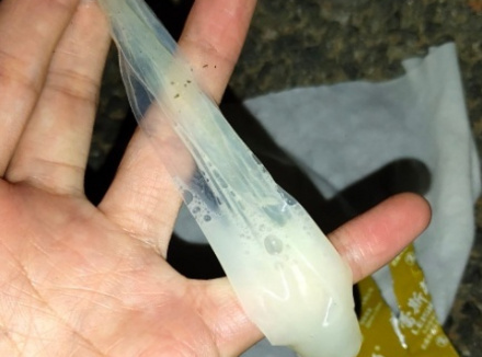 刚刚使用完的避孕套大概长什么样子
