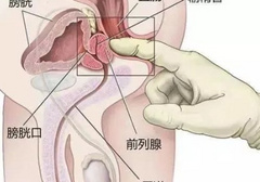 前列腺高潮一般激活要多久