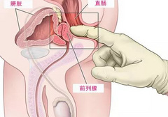 前列腺高C男人的第二快感