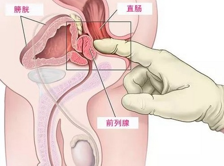 前列腺高C男人的第二快感