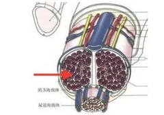 怎么判断原发性早泄？