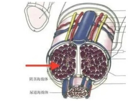 怎么判断原发性早泄？