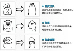 龟头敏感怎么办 4个方法增加龟头敏感度