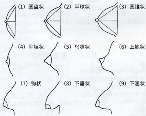 奶型一共分多少种类型