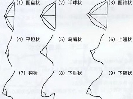 奶型一共分多少种类型