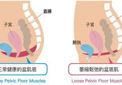 松弛怎么变紧致？女人都应该了解的凯格尔运动！