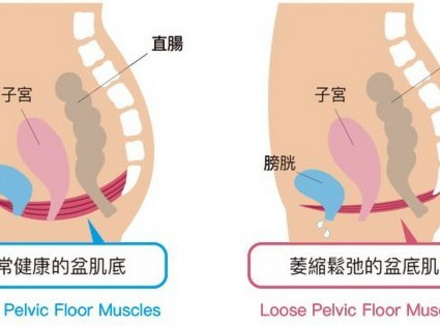 松弛怎么变紧致？女人都应该了解的凯格尔运动！