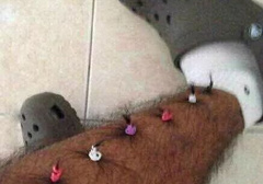 男性腿毛少是性功能差吗