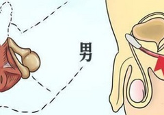 pc肌锻炼真的可以提高性功能