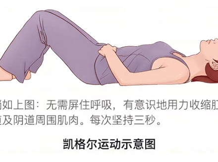 凯格尔需要坚持训练多长时间才有效果