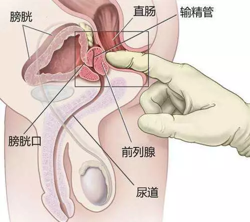 怎么摸？简单，看图！